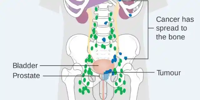 1966: Hormonal Treatment of Prostatic Cancer