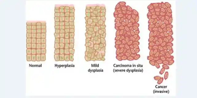 1975: Viruses as the Cause of Tumors