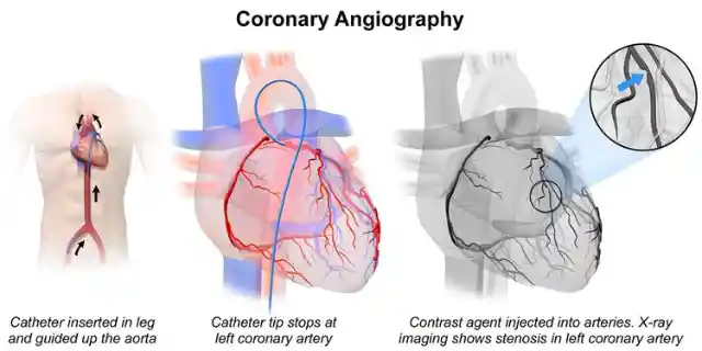 1956: Cardiac Catheterization