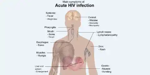 1983: HIV Identified as Cause of AIDS