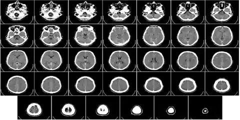 1946: Mutations by X-Ray Radiation