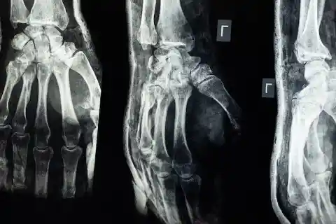 4. X-Rays