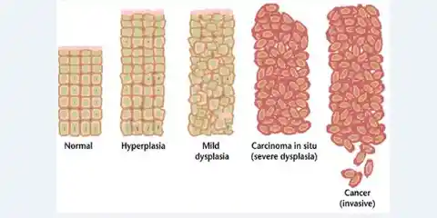 1975: Viruses as the Cause of Tumors